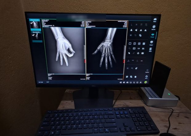 Digital radiography workstation displaying hand radiographs acquired with the flat panel detector