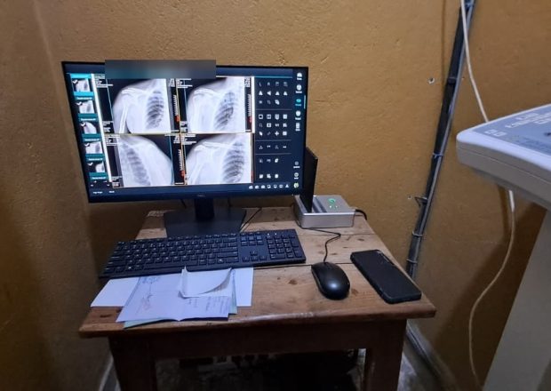 Radiology reporting workstation displaying shoulder radiographs in the imaging department